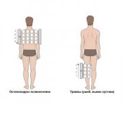 Аппарат магнитотерапевтический АЛМАГ-02, вариант поставки 2, 2 излучателя