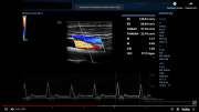 УЗИ аппарат Mindray DC-80 экспертный класс, общие исследования