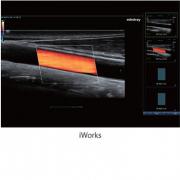 УЗИ аппарат Mindray DC-60 PRO (X-insight) высокий класс, общие исследования
