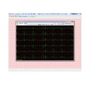 Компьютерный электрокардиограф КРП-01 НПП "МОНИТОР"
